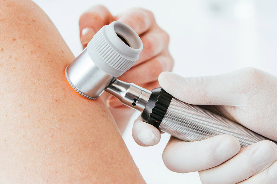 Dermatologist in latex glove holding dermatoscope while examining patient